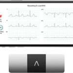 KardiaMobile 6-Lead Personal EKG Monitor – Six