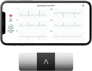 KardiaMobile 6-Lead Personal EKG Monitor – Six